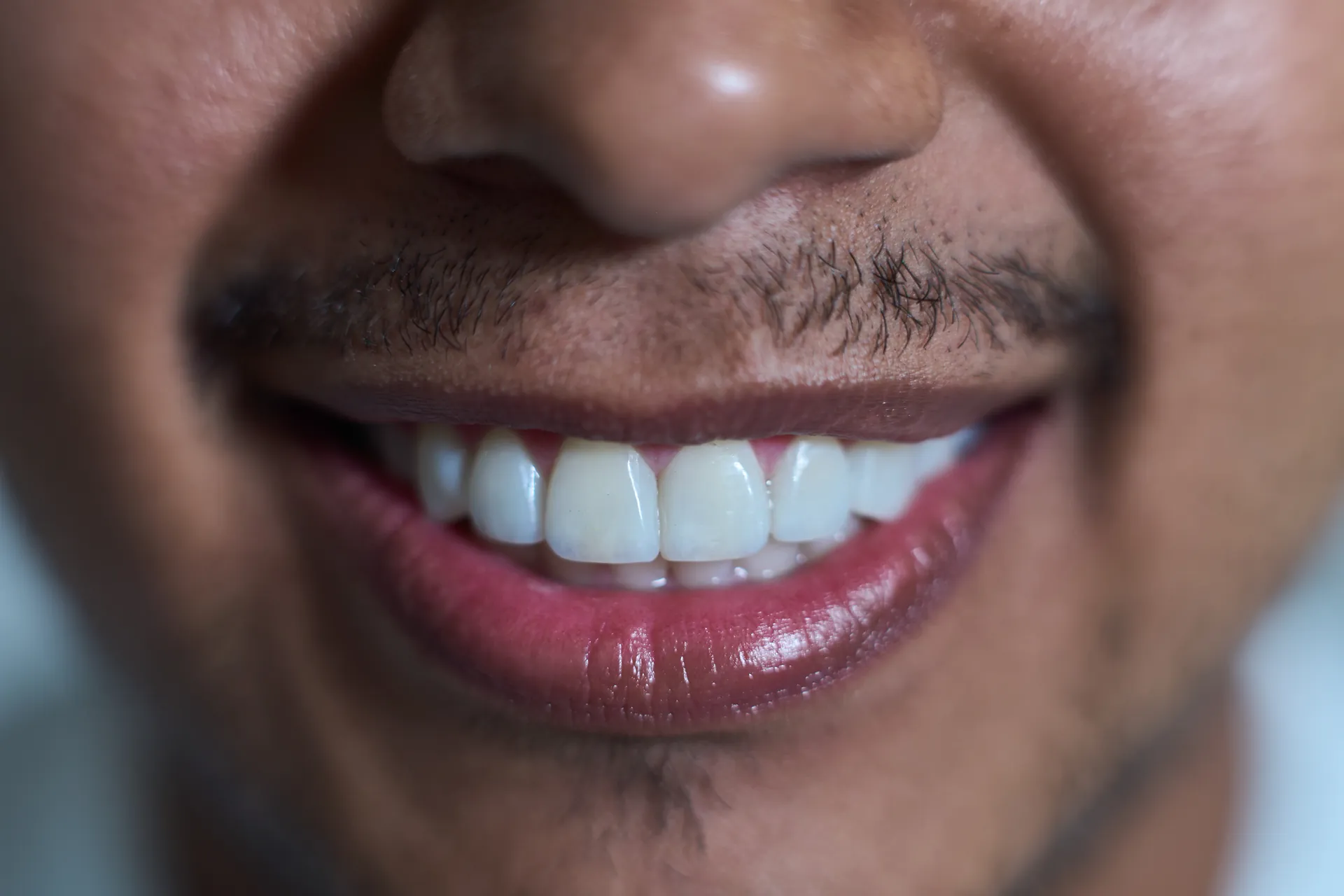 Sonrisa después del tratamiento